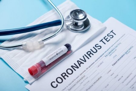 Apteklərdə satılan koronavirus testlərinin doğruluq göstəricisi nə qədərdir? - VİDEO