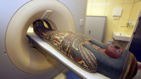 Mumiyanı rentgen aparatına saldılar: ŞOK OLDULAR - “YAŞAYIR”
