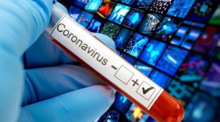 Koronavirusun daha bir növü aşkarlandı - 46 mutasiyanı özündə birləşdirir