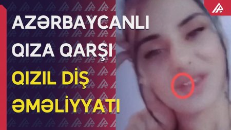 Polis qızıl dişli Ləmanı tutdu: Görün nə etdi - ŞOK VİDEO