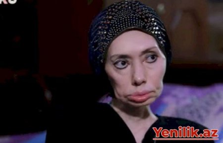 Ayna Sultanovanın nəticəsi: “Erməni tibb bacısı məni əlil etdi” - Video