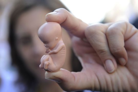 15 ildən sonra qadının qarnından bu çıxdı –İNANILMAZ, HƏR KƏS ŞOKDA