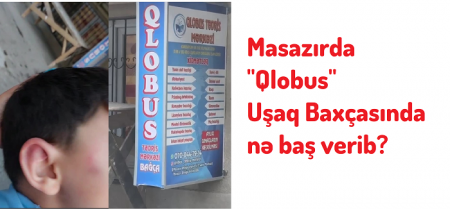 Masazırda "Qlobus" uşaq baxçasında körpəyə şiddət göstərilib? VİDEO