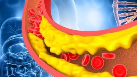 Xolesterol səviyyəsini azaltmaq üçün bir nömrəli protein