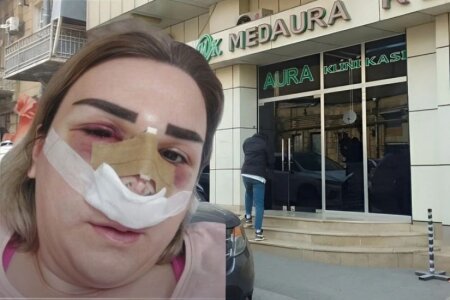 Daha bir pasiyent Şikayəti.....“MedAura”nın həkimi Kəmalə Mirzəyevaya 1400 manat vermişəm......