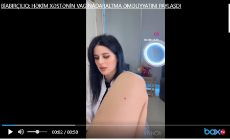 HƏKİM XƏSTƏDƏ APARDIĞI BU ƏMƏLİYYATI PAYLAŞDI-RƏZALƏT/ŞOK VİDEO