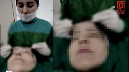 Xəstənin dərisini əlində tutan cərrah canlı yayım AÇDI – ANBAAN VİDEO
