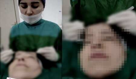 "Tuana estetic centre" cərrahı Esmira İbrahimli haqqında araşdırma başlandı.....