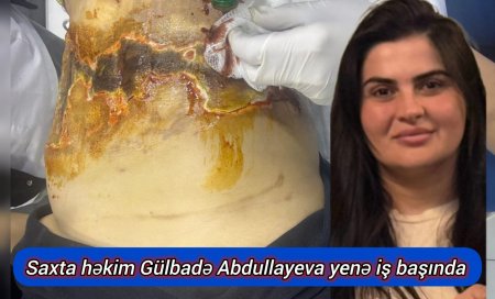 "Saxta həkim Gülbadə Abdullayevanın əməliyyatında yenə də zərərçəkənlər var" — Qalmaqal böyüyür təkzib verən xəbər portalı məhkəməyə verildi