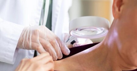 Dəri xərçəngindən qorunmağın sadə üsulu açıqlandı