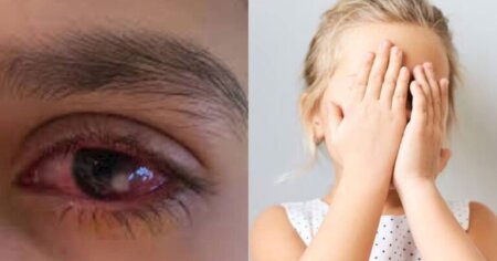 Endokrinoloqdan xəbərdarlıq-UŞAĞIN GÖZÜ BU SƏBƏBDƏN GÖRMÜR