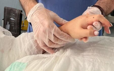 Bakıda qadının qopmuş qolu yenidən yerinə tikildi - FOTO