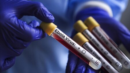 Eboladan ölənlərin sayı 2476 nəfərə çatıb